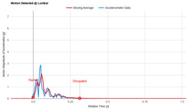 Boring Hybrid Lumbar Motion Isolation
