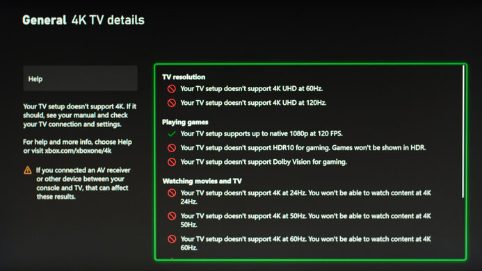BenQ ZOWIE XL2586X XSX Compatibility Photo