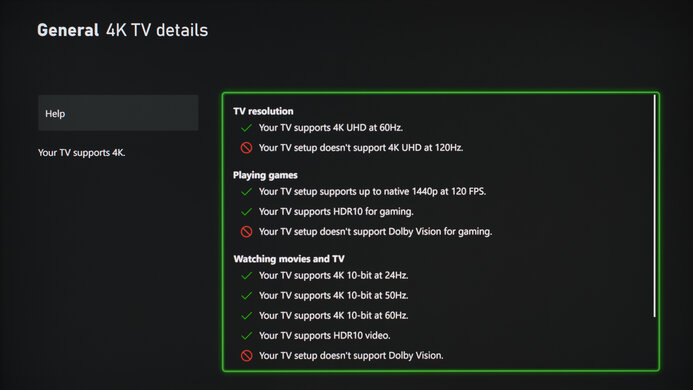 LG 27GR75Q-B XSX Compatibility Photo